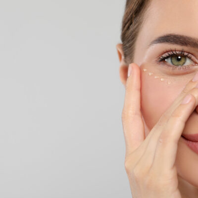 Young woman with cream around eye on white background, closeup. Space for text